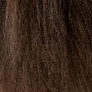 Flaky, irritated scalp