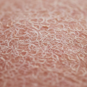 Dry, itchy skin