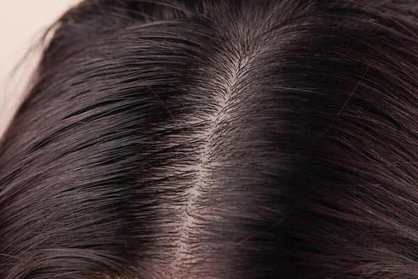 A calmer, healthier scalp