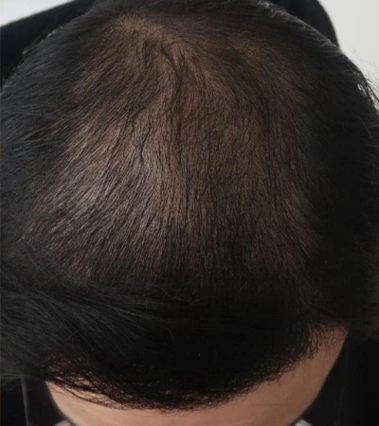After